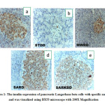 Figure 1: The insulin expression of pancreatic Langerhans beta cells with specific antibody and was visualized using BX53 microscope with 200X Magnification
