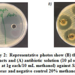 Supplementary 2:  Representative photos show (B) the inhibition of methanol extracts and (A) antibiotic solution (10 μl of Penicillin and streptomycin at 1g each/10 mL methanol) against Staphyloccocus areus and negative control 20% methanol.