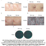 Figure 1: Combined Fish Collagen with Djulis, and Green Caviar Improved Skin Gloss, Wrinkles, Pore Area, Smoothness and Collagen.