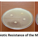 Figure 1: Antibiotic Resistance of the Microorganisms.