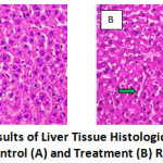 Figure 1: The Results of Liver Tissue Histological Examination in Control (A) and Treatment (B) Rats.