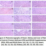 Figure 3: Photomicrographs of Heart, Kidney and Liver of Rats Fed Control; Protein Deficient (PD) and MOLM Supplemented (PD3, PD5 and PD10) Diets